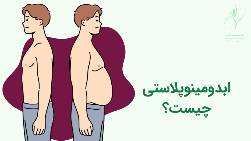 ابدومینوپلاستی چیست