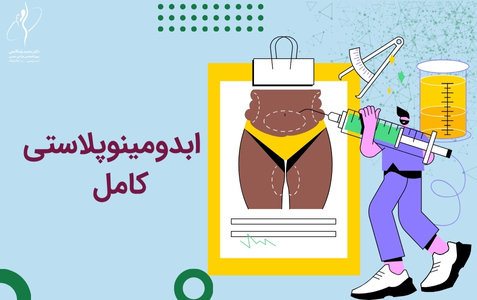 جراحی ابدومینوپلاستی کامل