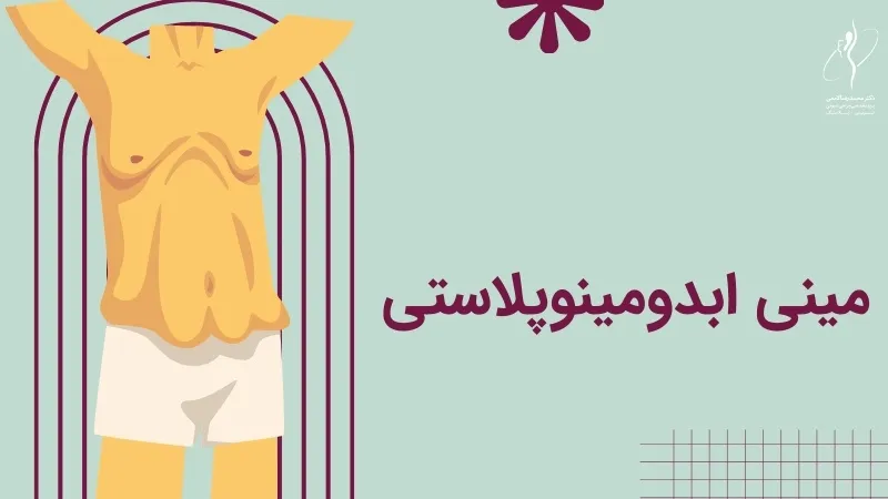 مینی ابدومینوپلاستی