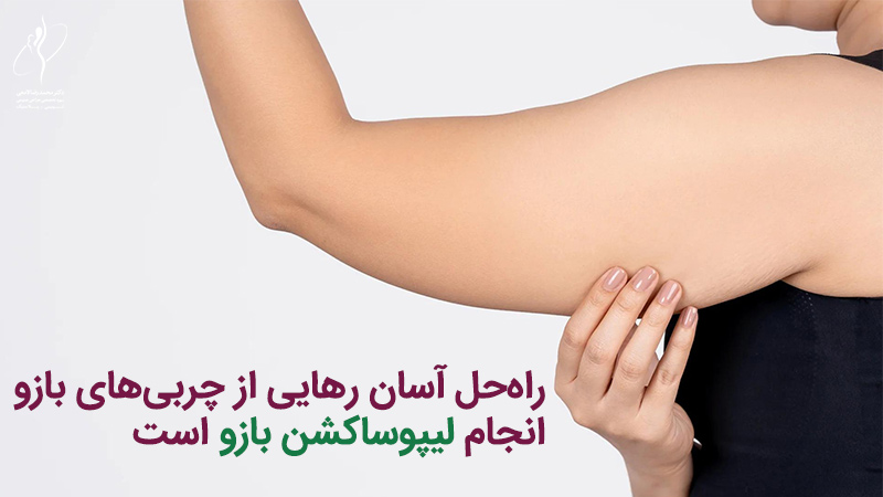 لیپوساکشن بازو چگونه است