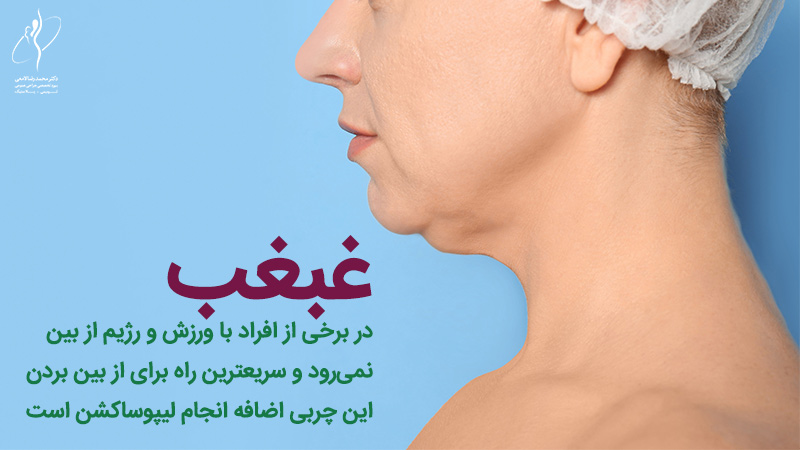 لیپوساکشن غبغب چیست