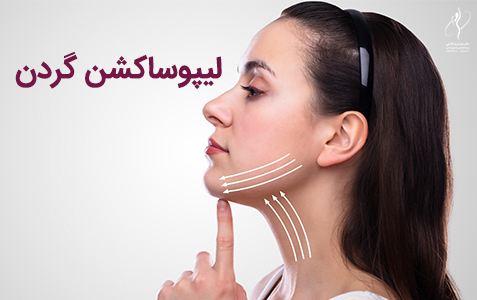 لیپوساکشن گردن | ساکشن گردن