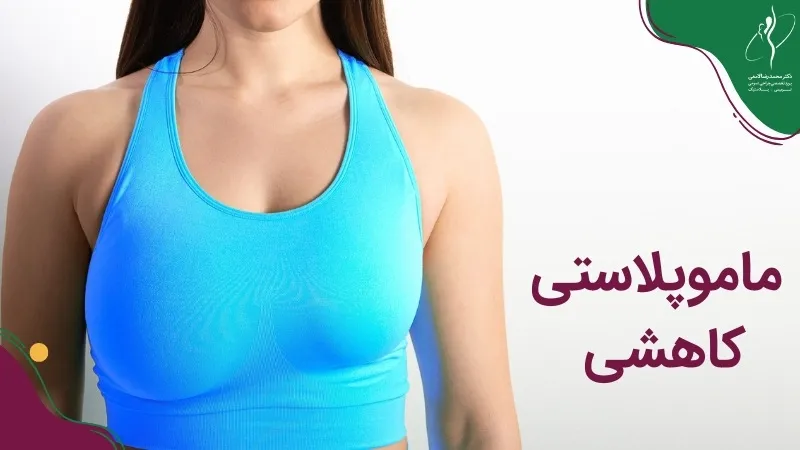 ماموپلاستی کاهشی