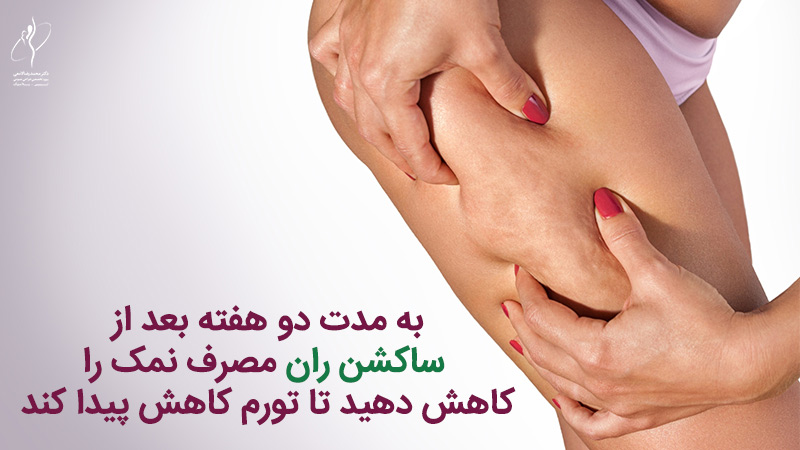 مراقبت‌های بعد از لیپوساکشن ران