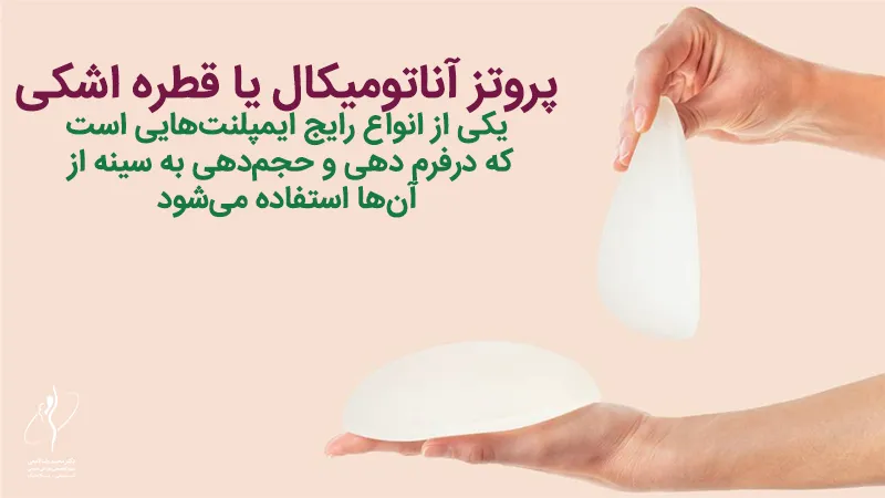 پروتز آناتومیکال یا قطره اشکی