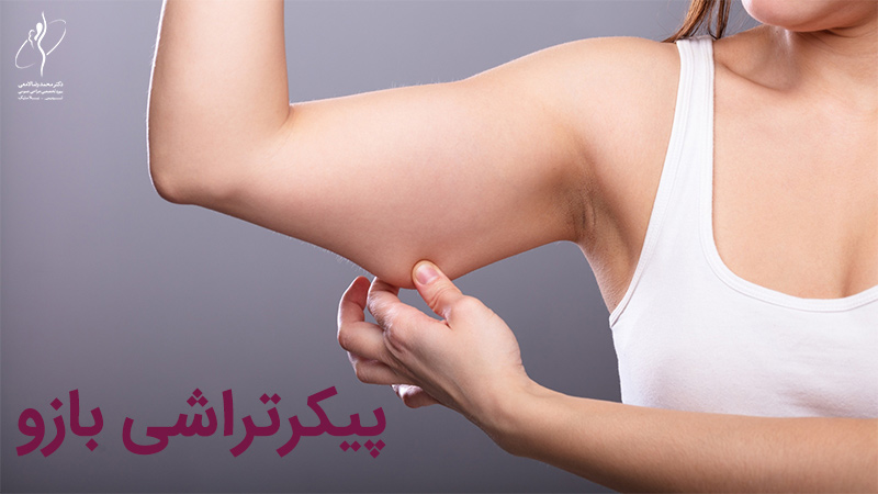 پیکرتراشی بازو