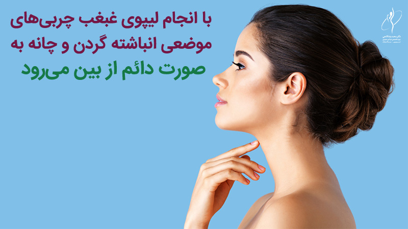 کاندیدهای مناسب برای لیپوساکشن گردن