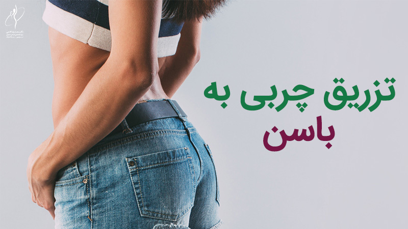 تزریق چربی به باسن