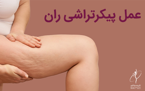 عمل پیکرتراشی ران