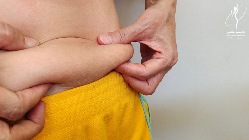 خطرات عمل ابدومینوپلاستی