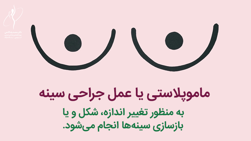 جراحی ماموپلاستی