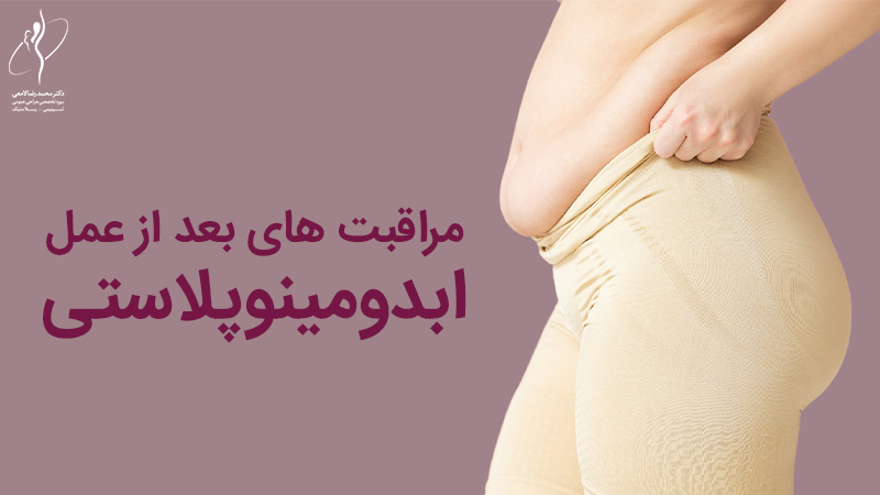 مراقبت های بعد از عمل ابدومینوپلاستی