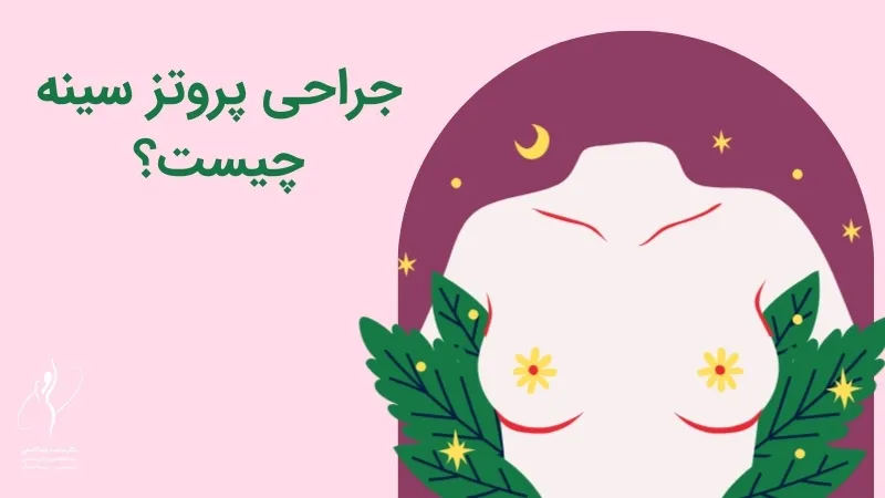جراحی پروتز سینه