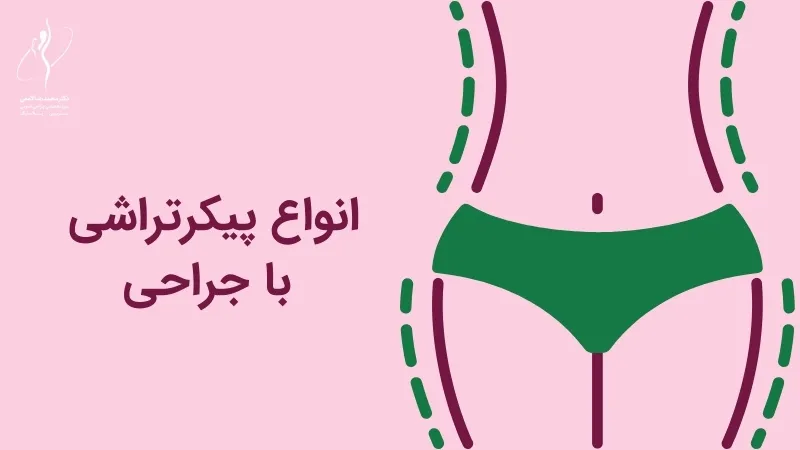 انواع پیکرتراشی با جراحی