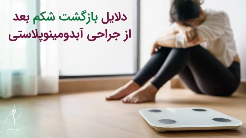 دلایل بازگشت شکم بعد از جراحی ابدومینوپلاستی