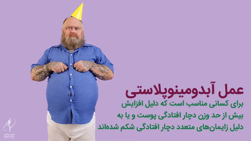 شرایط لازم برای عمل ابدومینوپلاستی