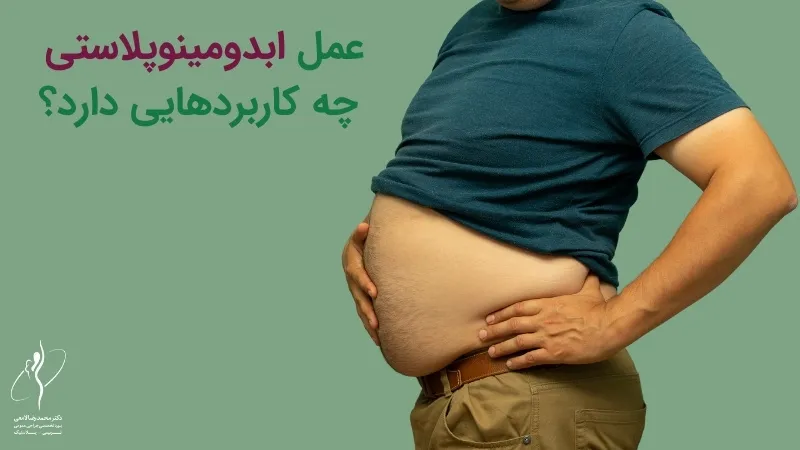 عمل ابدومینوپلاستی چه کاربردهایی دارد