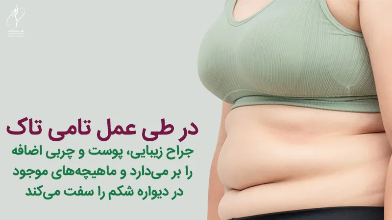 عمل تامی تاک
