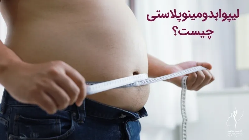 لیپو ابدومینوپلاستی چیست