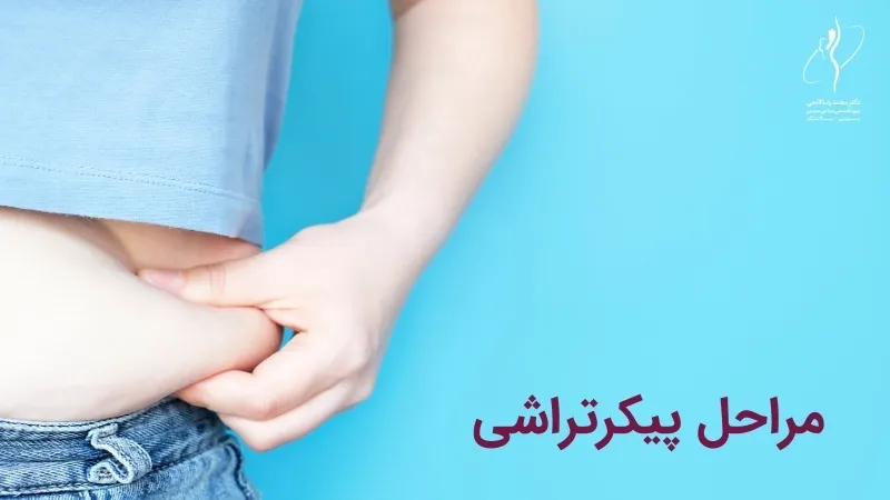 مراحل پیکرتراشی