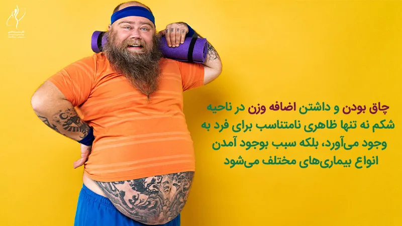 مزایای عمل ابدومینوپلاستی
